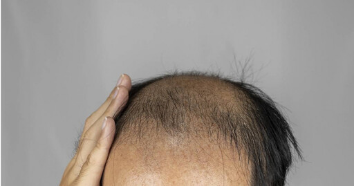 妹子和禿頭男約會2次！拒交往被要求費用AA 她傻眼：買單不是很正常？全場搖頭