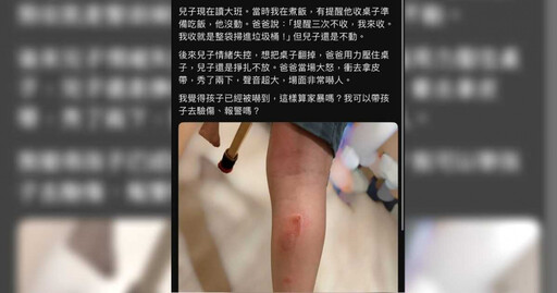 大班兒翻桌遭父揮皮帶打2下 媽見傷勢心疼:可報警嗎?2派吵翻