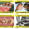 3月22日起菸品容器健康警示圖文須占50% 舊包裝不得販售