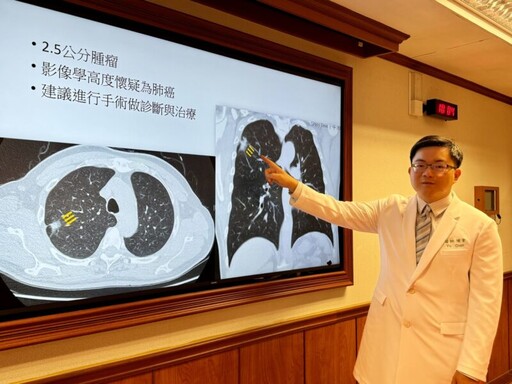 高雄長庚多元高端治療助肺癌病人 達文西肺臟手術納健保
