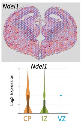 高雄長庚研究團隊 發現「平腦症」致病新基因—NDEL1