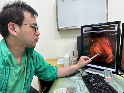定期接受癌症篩檢 及早揪出大腸息肉潛在危機