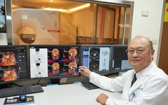 以自身罹腺癌故事 醫師呼籲正視癌症早期偵測