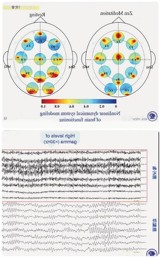 【禪與科學】禪定的腦科學研究