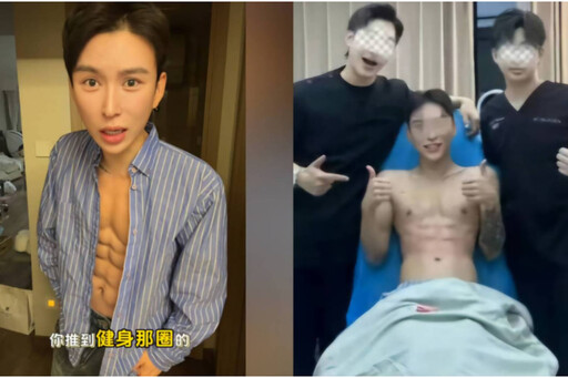 大陸首例「玻尿酸八塊腹肌」 網紅花1700萬台幣挑戰極限體態