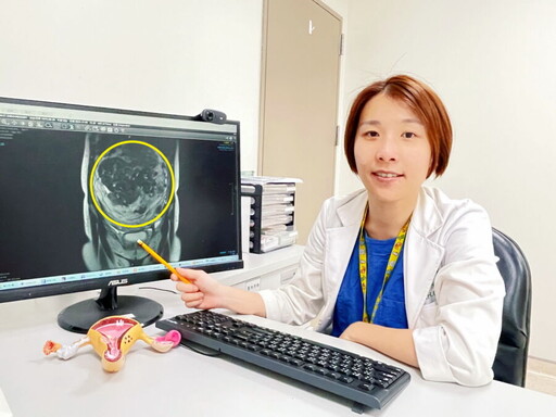 土城醫院：達文西機器手臂輕鬆摘除25公分巨大子宮肌瘤