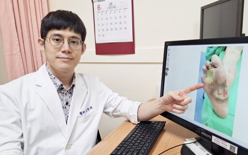 糖尿病患腳底潰爛險截肢 莊智超醫師：每日檢查雙腳是關鍵