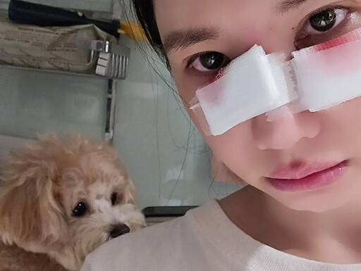 樂天女孩筠熹「濺血照」曝光！遭愛犬咬傷臉破相臨時停工