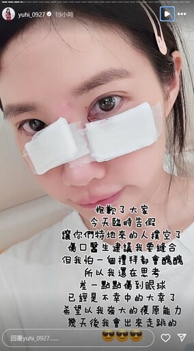 樂天女孩筠熹「濺血照」曝光！遭愛犬咬傷臉破相臨時停工