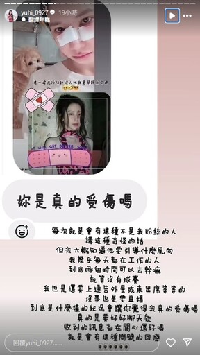 樂天女孩筠熹「濺血照」曝光！遭愛犬咬傷臉破相臨時停工