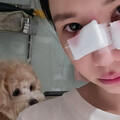 樂天女孩筠熹「濺血照」曝光！遭愛犬咬傷臉破相臨時停工