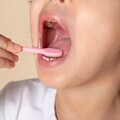 牙套配戴5年卻爛牙8顆！醫揭女子清潔方式令人搖頭