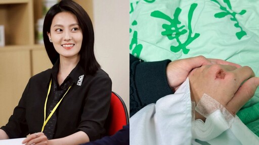 女星遭撞驚悚畫面曝光！倒地滑行數公尺「被迫按下了人生暫停鍵」