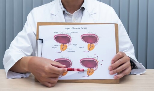 重「腺」健康人生 醫：預防攝護腺肥大應少吃紅肉等高膽固醇食物