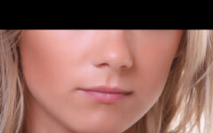 鼻整形不僅美觀 還能改善呼吸功能
