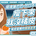你也有「橘皮」大腿？醫曝4大高危族群，瘦子也難逃！