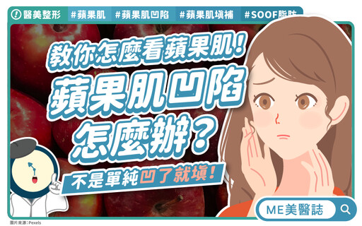 你以為那是眼袋?其實是蘋果肌流失!