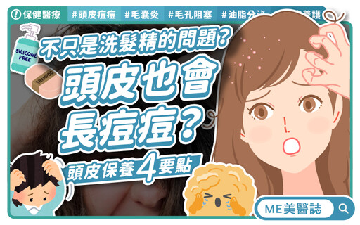 頭皮竟是痘痘溫床 醫師揭5招有效擊退頭皮痘