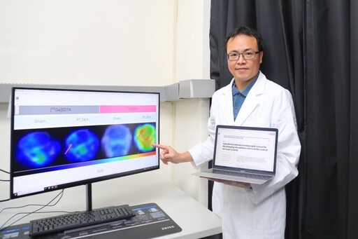 全球首創氧化壓力偵測技術 中山大學研究有望緩解阿茲海默症