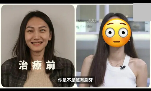 妙齡女整牙後變女神網貼驚人對比