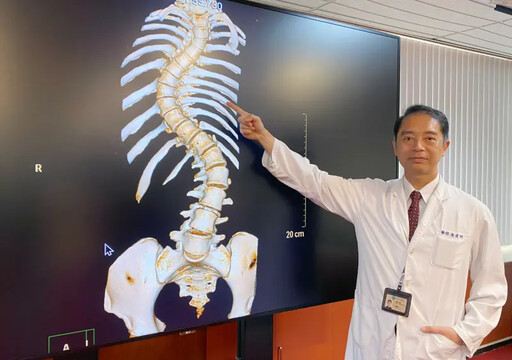 女大生脊椎「長整條蜈蚣」 1手術長高8公分