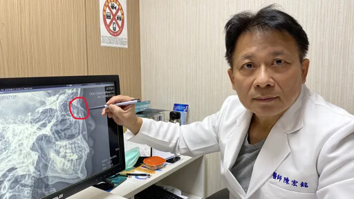 孩子猛一撞！30歲媽鼻子骨折 醫示警1危機