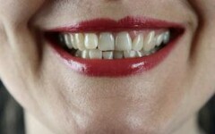 好想擺脫黃牙！6大牙齒美白方式找回自信笑容