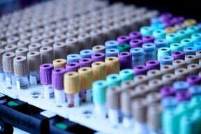 定期「婦科檢查」不能少！網推四大項目不漏檢 守護女性健康