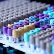 定期「婦科檢查」不能少！網推四大項目不漏檢 守護女性健康