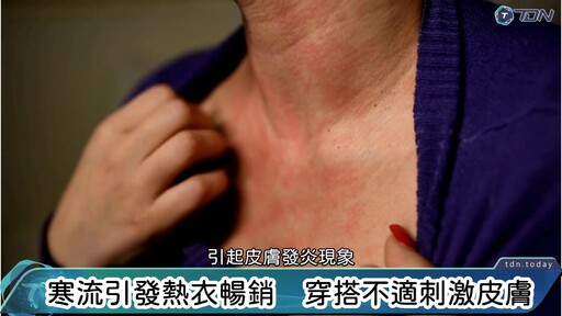 影／發熱衣冬季狂銷熱賣 皮膚科醫：許多民眾穿出濕疹