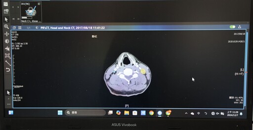 花蓮慈濟醫院獲3項國家新創獎肯定