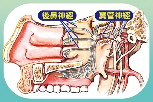 阻斷後鼻神經縮減下鼻甲 打鼾女戰勝鼻過敏