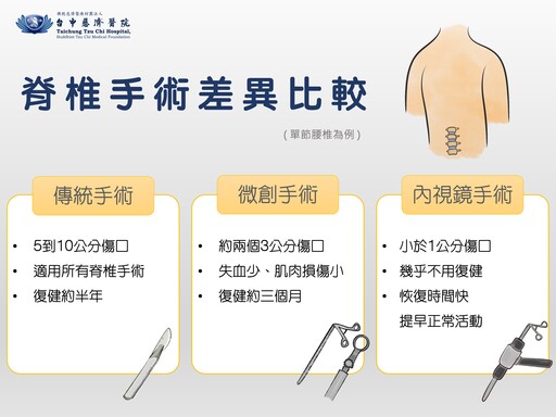 預防打掃下背痛 中慈骨科醫師有「撇步」