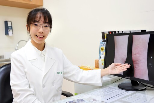 氣候變化大 花蓮慈院醫師提醒護膚免受濕疹困擾
