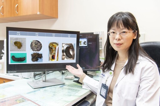 影音/8歲女童吞髮導致毛結石 彰基兒醫團隊呼籲關注兒童心理健康