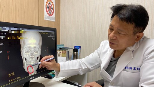 兩歲孩往媽媽鼻子一撞鼻骨竟斷了 醫師呼籲:顏面受傷把握黃金治療期