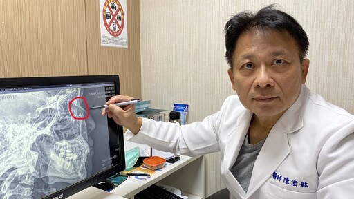 兩歲孩往媽媽鼻子一撞鼻骨竟斷了 醫師呼籲：顏面受傷把握黃金治療期