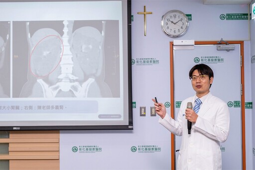 影音/切除6公斤多囊腎 彰基活腎移植助教師重返講台