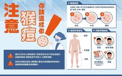 11月增7例M痘 個案分散北中南