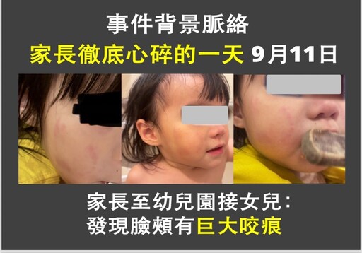 女童上學一個月滿臉咬痕 新北市議員張嘉玲討公道