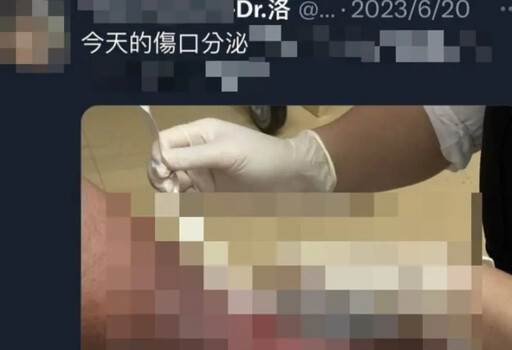 網傳台南醫偷拍病患隱私照 警受理報案偵辦