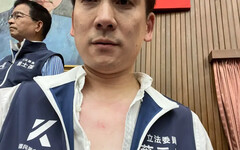 葉元之怒PO「胸口抓傷」照：民進黨暴力黨