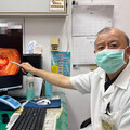 大腸癌連年奪命第一 醫：排便異常別拖延