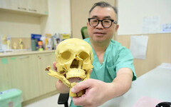 建築工臉部碎裂差點毀容 隱形切口神救援