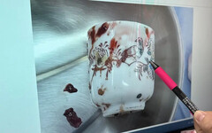 男不能說的秘密 肛門卡杯子 醫看：太扯了