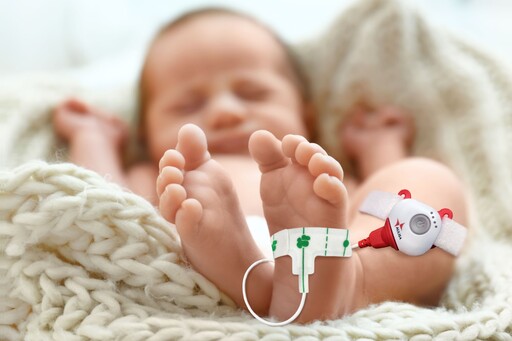 「2024年台灣醫療科技展」亮點 嬰兒血氧產品新尖兵