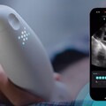 三星創投擬參與Exo新一輪募資 AI掌上超音波裝置引發關注
