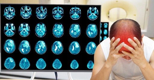 致命腦癌露曙光！CAR-T新療法讓腫瘤縮小率達62%