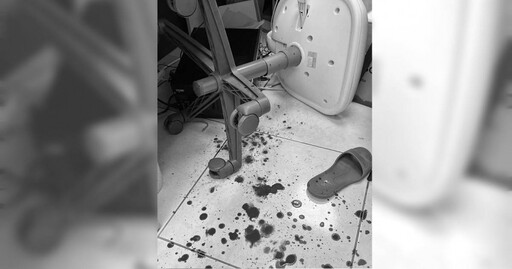 有那麼痛?北市男不滿洗牙痛爆揍女醫師 犯後至分局主動投案