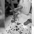 有那麼痛？北市男不滿洗牙痛爆揍女醫師 犯後至分局主動投案